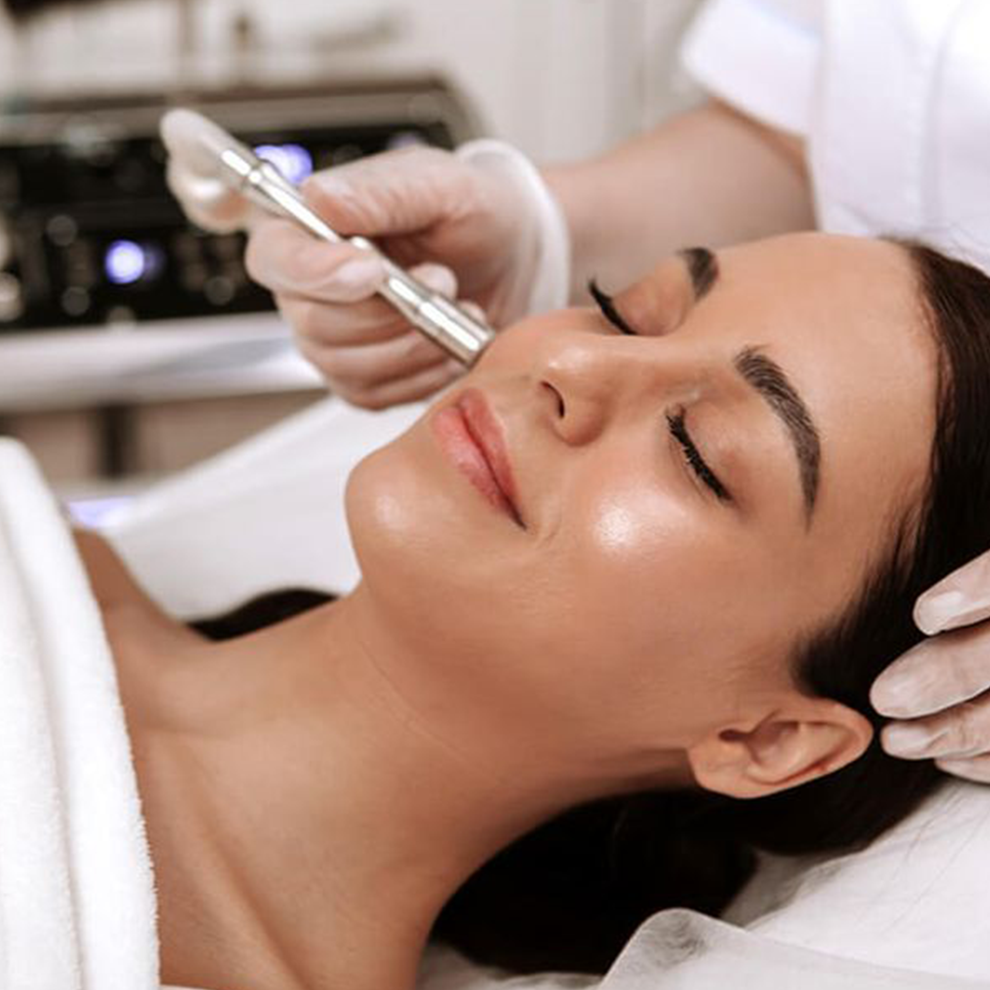 microdermabrasion